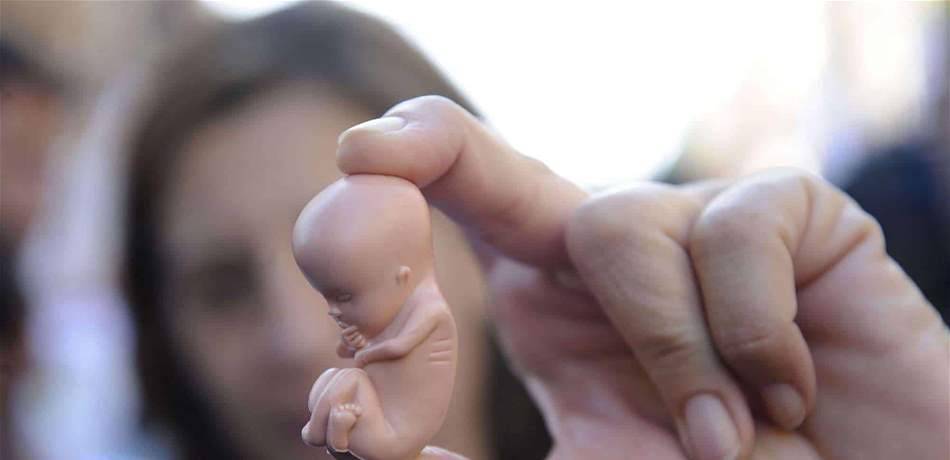 العلم يكشف: الحيوانات المنوية "مسؤولة" عن الإجهاض المتكرر