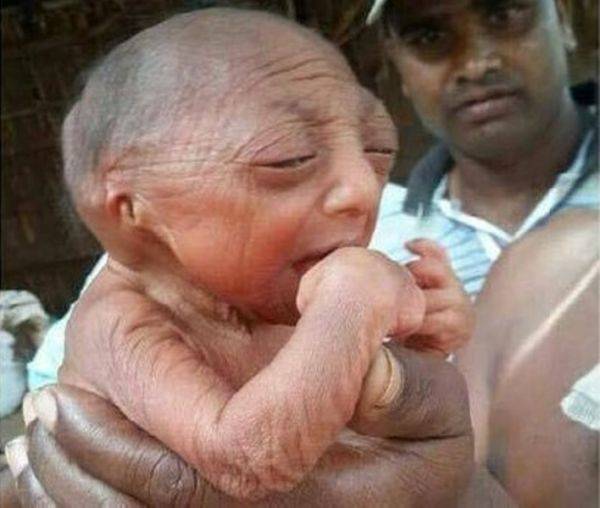 بالصورة: مولود غريب في بنغلادش