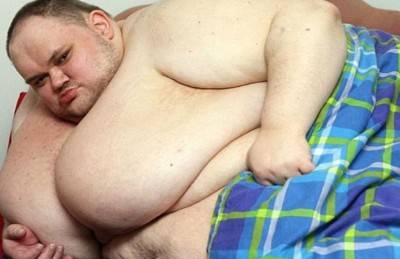 وفاة أضخم رجل في بريطانيا عن عمر 33عاماً