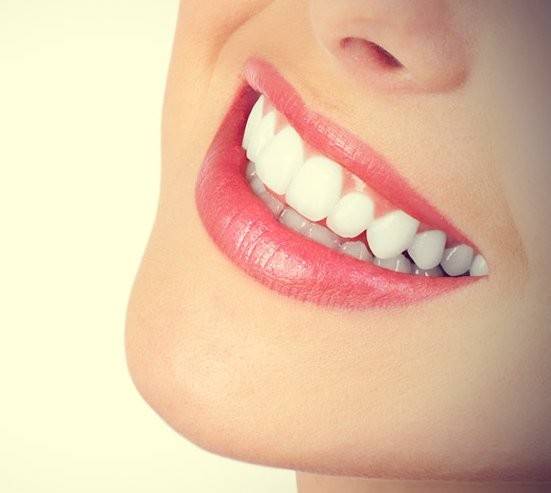 كيف تعالج أسنانك دون الحاجة إلى طبيب؟