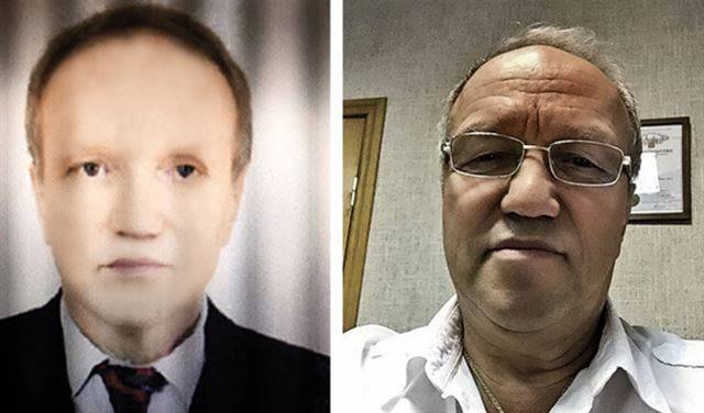تحول إلى اللون الأسود بعد عملية زراعة كبد!
