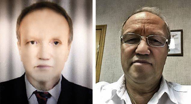 زرع كبد من متبرع فتغير لون بشرته!