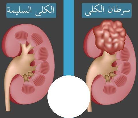 إحذروا الدجاج المليء بـ 