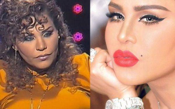 صور فاضحة للفنانات قبل وبعد التجميل