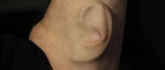 بروفيسور استرالي له أذن ثالثة تعمل على الـ"الواي فاي"