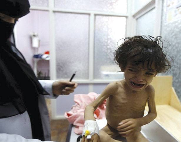 اليمن : السعوديّة تقصف ميناء الحديدة
العفو الدوليّة : إحتقار واضح لأمن المدنيين