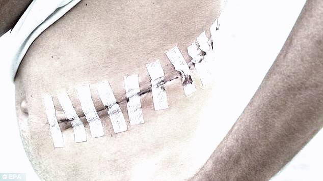 حقائق صادمة ..."داعش" تموّل هجماتها الإرهابية من  الأعضاء البشرية!