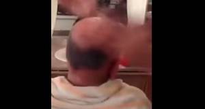 بالفيديو.. أغرب طريقة لعلاج الصلع في الهند