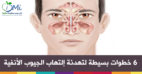 6 خطوات بسيطة لتهدئة إلتهاب الجيوب الأنفية

ا



ا