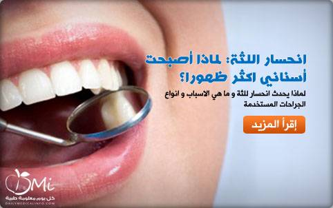 انحسار اللثة: لماذا أصبحت أسناني اكثر ظهورا؟