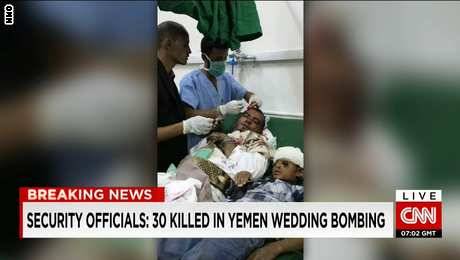 قرابة مائة قتيل وجريح في قصف استهدف حفل زفاف بمنطقة خاضعة للحوثييين في اليمن