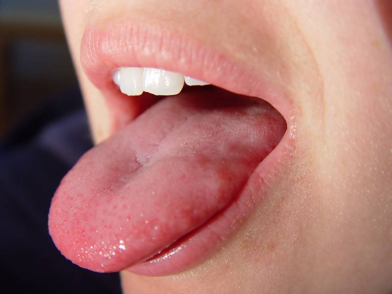 لماذا يصر الأطباء أثناء زيارتنا لهم في العيادة على طلبهم الدائم بفتح الفم ومد اللسان ..!؟