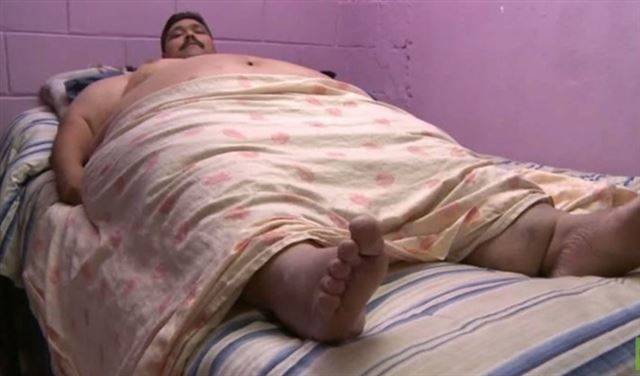 بالفيديو.. أسمن رجل في العالم تحت مشرط الجرّاح