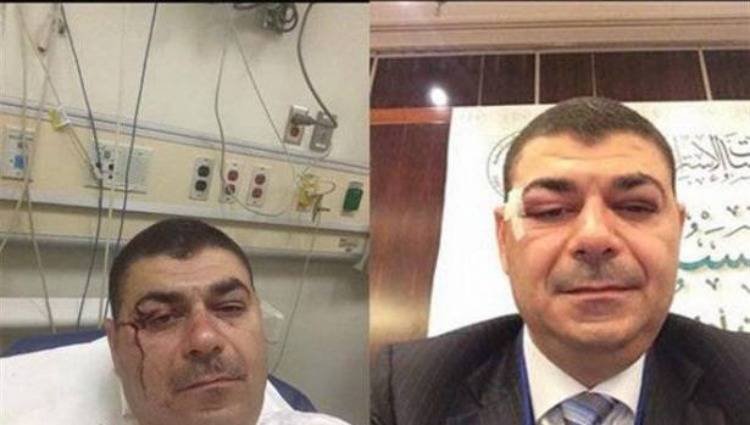 ما حقيقة تعرض النائب العراقي السابق الى عنف نسائي في بيروت؟