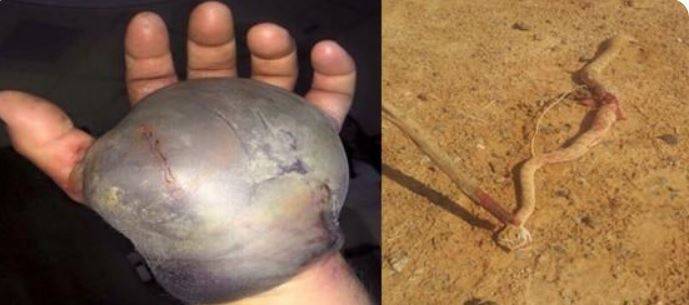 شاهد بالفيديو ..ماذا فعلت أفعى بيد سعودي اثناء تصويرها!