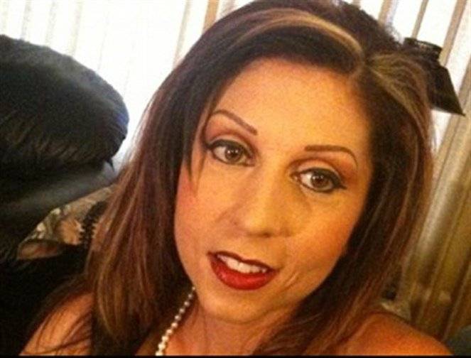 الصور تروي المأساة: من ممثلة إلى.. هيكلٍ عظمي
