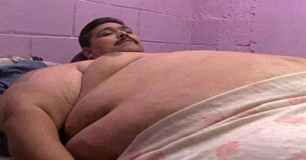 بالصورة: أضخم رجل في العالم خضع لجراحة تصغير معدة..فماذا حصل له؟