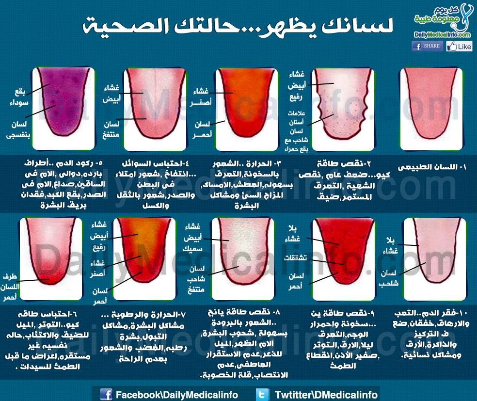لسانك يظهر حالتك الصحية
