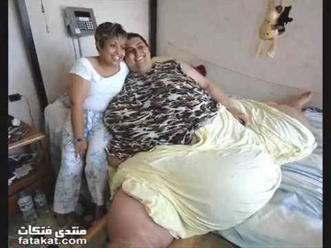 بالصور: أضخم امرأة في العالم تخسر 350 كيلوغرام من وزنها