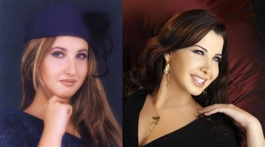 لن تصدق شكل الفنانات قبل وبعد عمليات التجميل