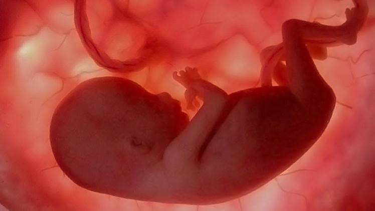 علماء: هناك جين من الجينات يجعل جنينا يموت في رحم الأم