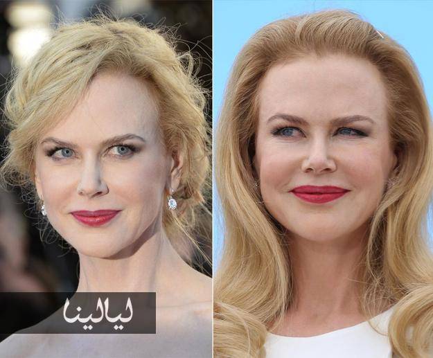 صور تفضح نجمات رفضن الاعتراف بقيامهن بعمليات تجميل