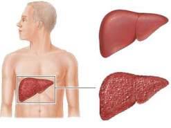 علاج جديد لفيروس 