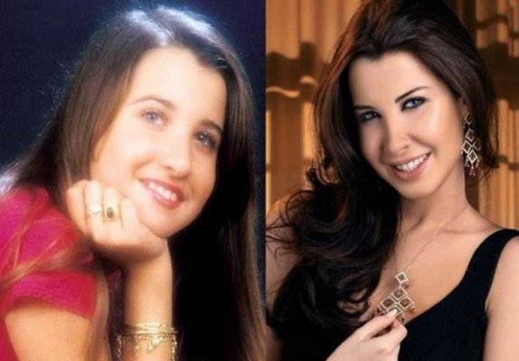 فيديو نادر لنانسي عجرم قبل عمليات التجميل