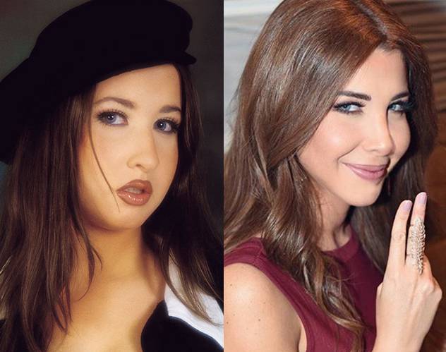 صور صادمة.. النجمات قبل وبعد عمليّة تجميل الأنف!