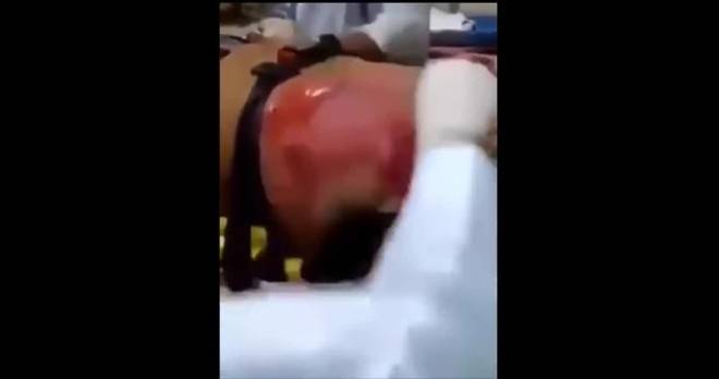 بالفيديو شاهد مصير رجل شرب 24 زجاجة مشروب طاقة