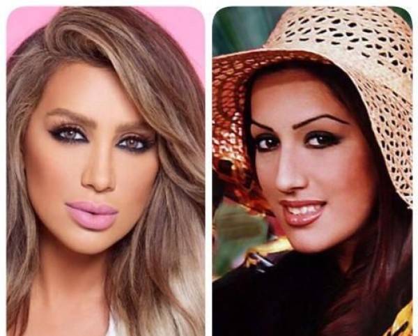 صور صادمة لـ 13 مذيعة عربية.. قبل التجميل وبعده!