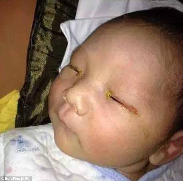 رضيع يفقد بصره بسبب صورة!