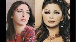 فضيحة الفنانات قبل و بعد عمليات التجميل بالفيديو