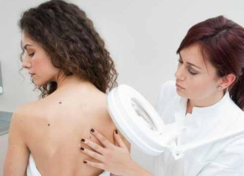 بهذه الطريقة تتخلصين من بثور الظهر!