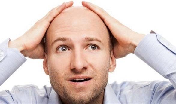 للرجال فقط.. وداعا للصلع
