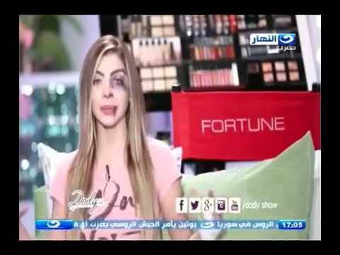 بالفيديو.. مذيعة مصرية تظهر على الشاشة وأثار تعنيف زوجها على وجهها واضحة!!