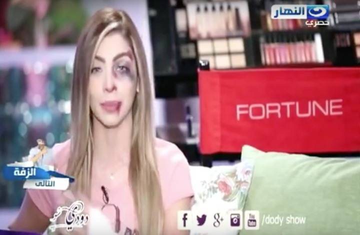 ما هو سر الكدمات وآثار الاعتداء على وجه دعاء صلاح؟ (فيديو)
