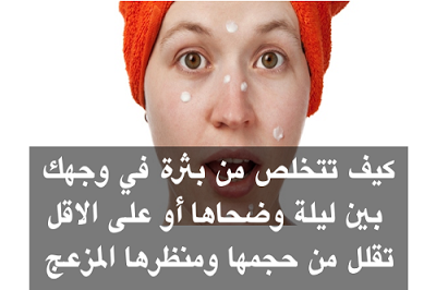 كيف تقضي على بثور الوجه في أقل من يوم؟