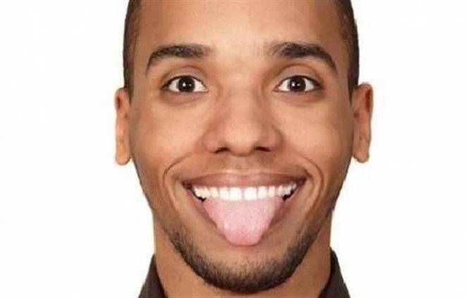 لماذا يصبح اللسان أبيض؟
