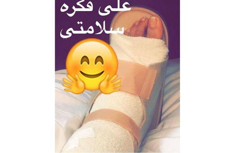 بالصورة.. أحلام تكسر ساقها