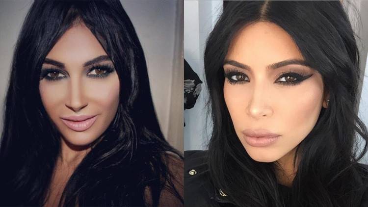 بالصور.. لن تصدّق... أشهر 10 عمليات تجميل للتشبه بالمشاهير!