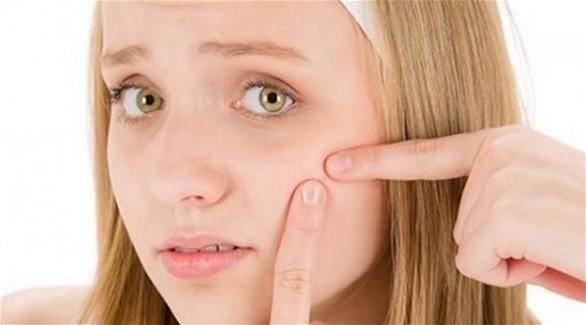 أخطاء ترتكبها عند التعامل مع حب الشباب