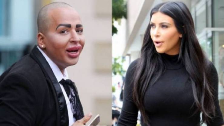 صور- أشهر 10عمليات تجميل للتشبه بالمشاهير !