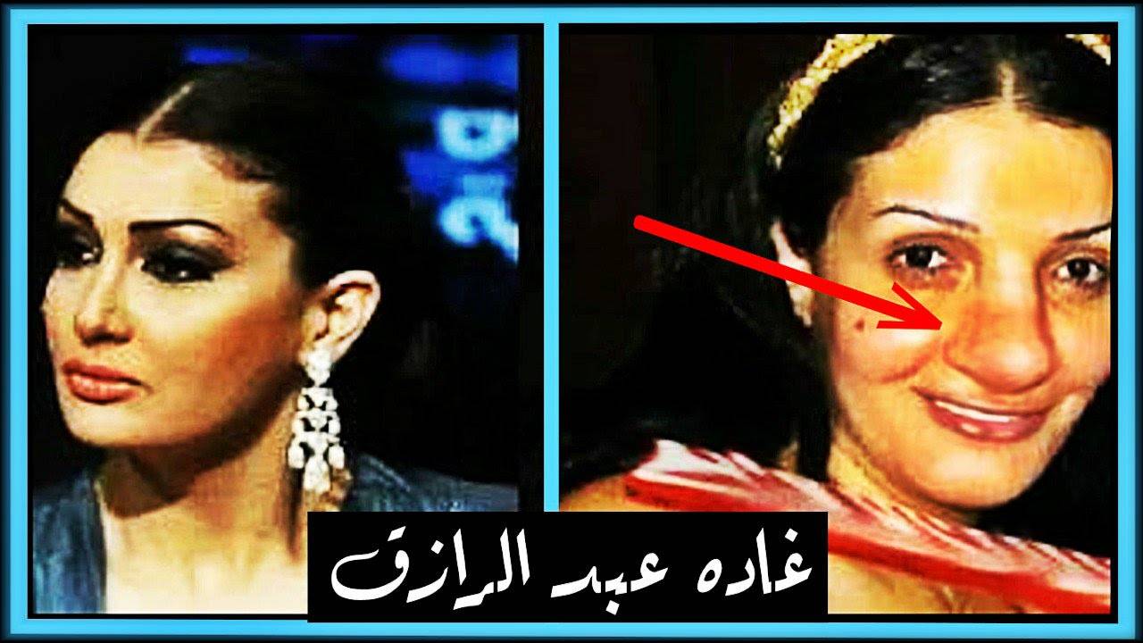 فيديو يستحق المشاهدة... لن تصدقوا اشكال الفنانين قبل الشهرة... فضائح!