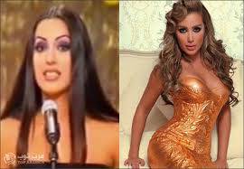فضائح صور الفنانات قبل وبعد عمليات التجميل...لا يفوتك!!!