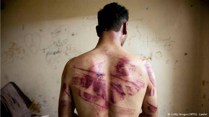 "القمع في مصر والتدخل السعودي في اليمن تسببا في جرائم فظيعة"