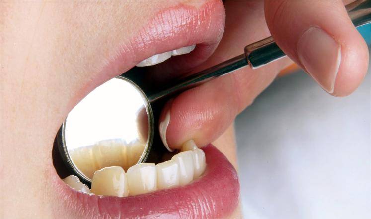 أمراض اللثة تفاقم خطر الإصابة بسرطان الثدي