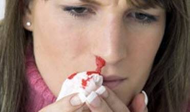 معلومات خطيرة عن نزيف الأنف...أسبابه وسبل علاجه