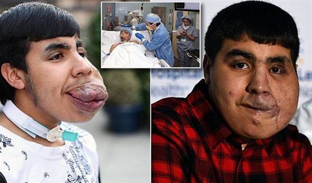 بعد مرور 15 سنة تحرر من معاناته ..التفاصيل في الداخل!