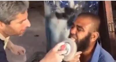 طريقة داعشية لتـنظيف الأسنان .. فيديو